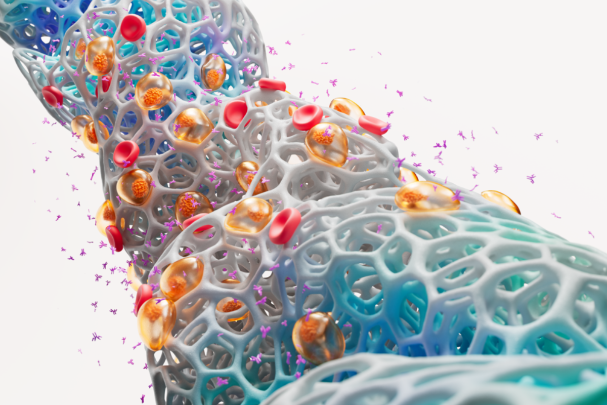 A scientific image of multiple myeloma