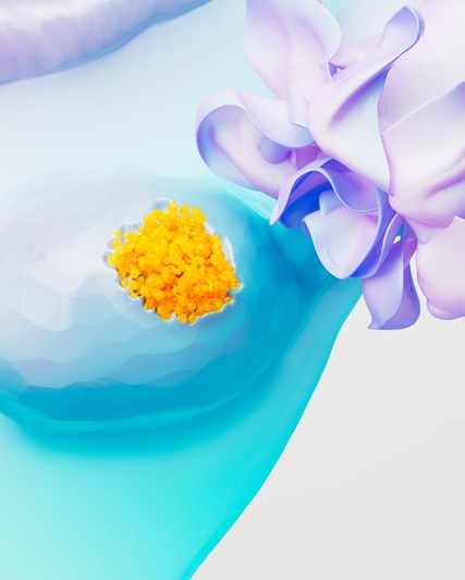 3D photo of ovarian cancer 