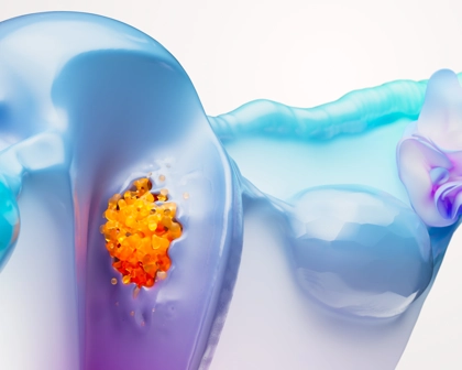 Endometrial Cancer Science Image