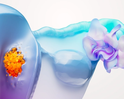 Endometrial Cancer Science Image