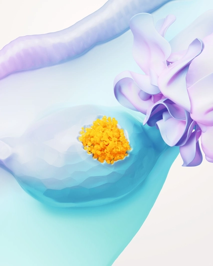 Ovarian Cancer