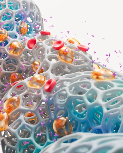 A scientific image of multiple myeloma