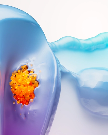 Endometrial Cancer Science Image